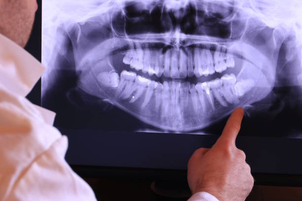 Best Emergency Dental Services Near Me  in Forest Meadows, CA