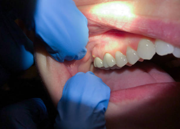 Best Urgent Dental Care  in Forest Meadows, CA