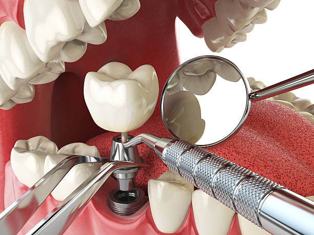 Best Affordable Emergency Dental Care  in Forest Meadows, CA