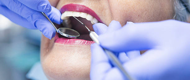 Best Emergency Tooth Extraction  in Forest Meadows, CA