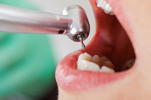Best Walk-In Dentist Near Me  in Forest Meadows, CA
